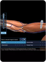 SpasticityArm